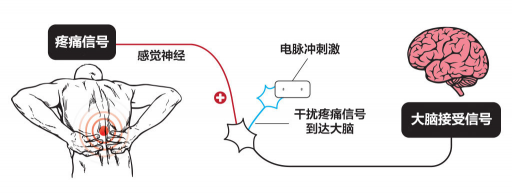 【ZE科普】一樣是電，為什么名字如此花哨