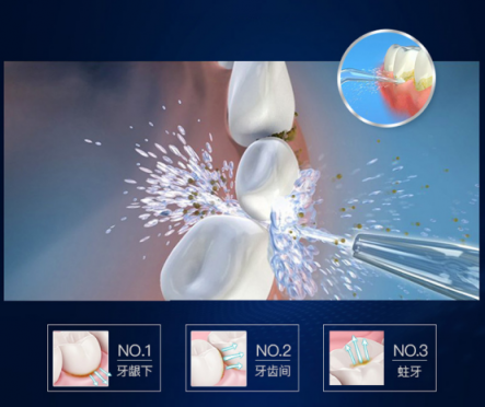 光靠刷牙解決不了牙齒困擾！沖牙器排行榜幫助你