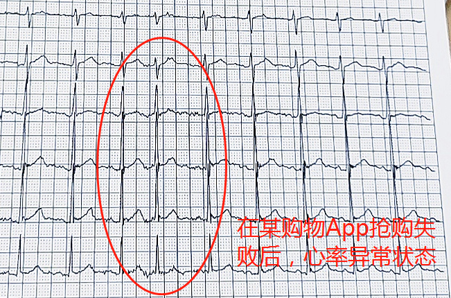 618網(wǎng)購致老人多次心率異常 ?醫(yī)生提示要選有保障的網(wǎng)購平臺