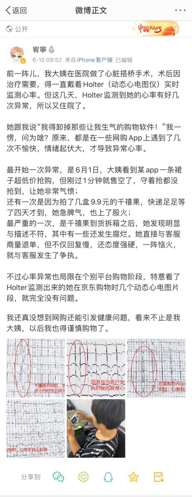 618網(wǎng)購致老人多次心率異常 ?醫(yī)生提示要選有保障的網(wǎng)購平臺