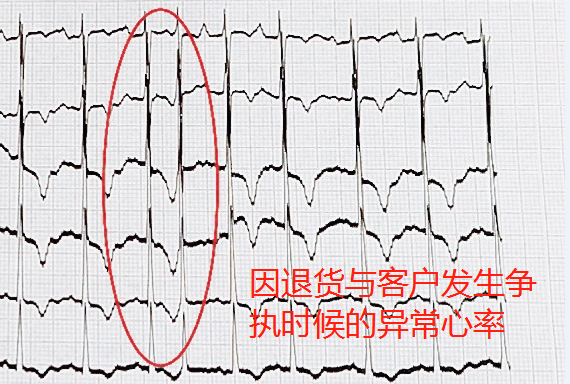 618網(wǎng)購致老人多次心率異常 ?醫(yī)生提示要選有保障的網(wǎng)購平臺