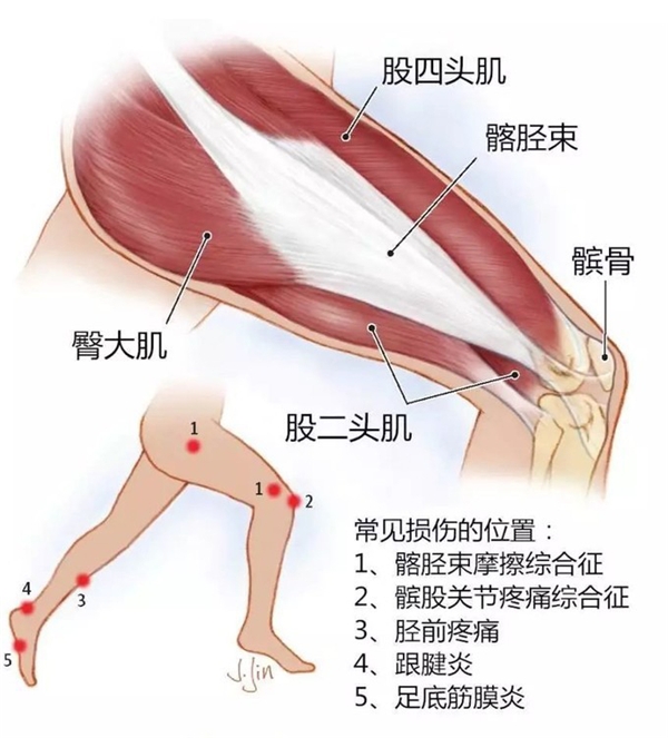 云麥筋膜槍 VS HYPERVOLT筋膜槍一哥的使用評測及感受