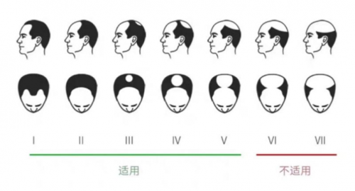 小米眾籌銷(xiāo)量驚人的可思美激光生發(fā)帽，真的能生發(fā)嗎？