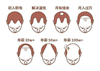 2.5億人被脫發(fā)困擾？Rogaine培健實(shí)力生發(fā)