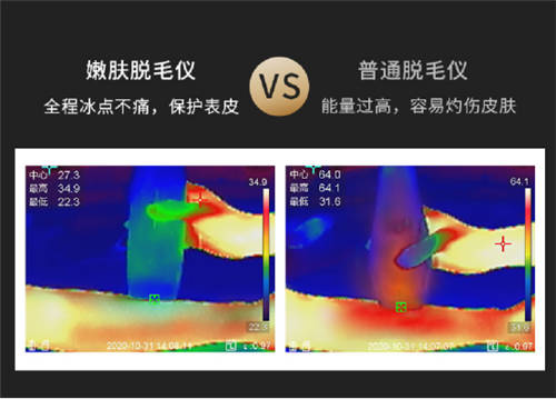 Ulike脫毛儀：硬核藍(lán)寶石級(jí)別，才是真正的冰點(diǎn)無痛