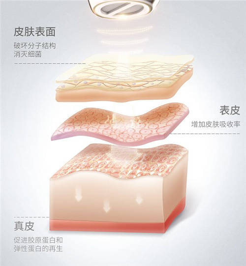 COSBEAUTY可思美專注研發(fā)，新品等離子凈膚儀憑實(shí)力圈粉