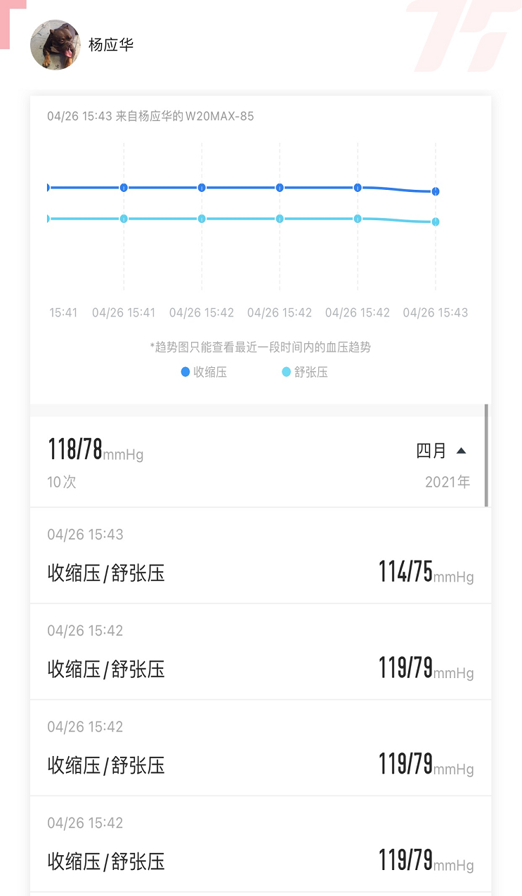 運(yùn)動健康管理全面升級75派智能手表W20 Max全新上市