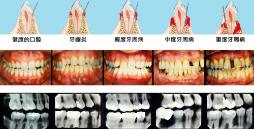 8月5日小米有品眾籌！素諾智能可視沖牙器C3 pro倒計(jì)時(shí)海報(bào)曝光