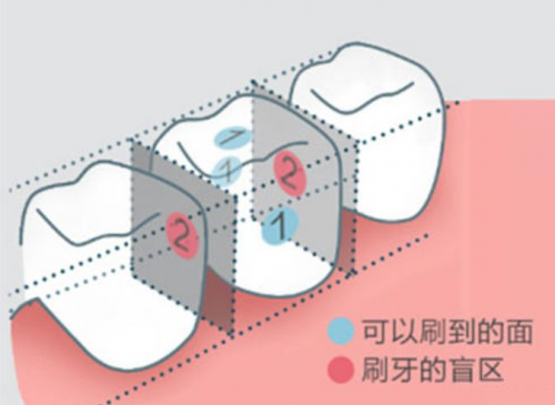 8月5日小米有品眾籌！素諾智能可視沖牙器C3 pro倒計(jì)時(shí)海報(bào)曝光