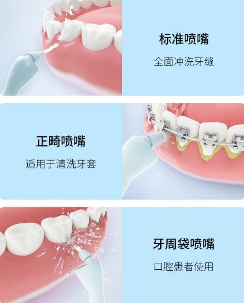 眾籌價僅269元！素諾智能可視沖牙器C3 pro小米有品眾籌開搶