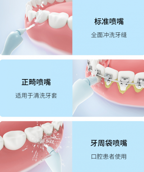 正畸人士福音！素諾智能可視沖牙器C3 pro看得清，沖得凈