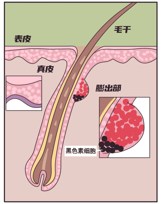 長胡子不是女生“原罪”，讓Ulike脫毛儀來為你解決煩惱