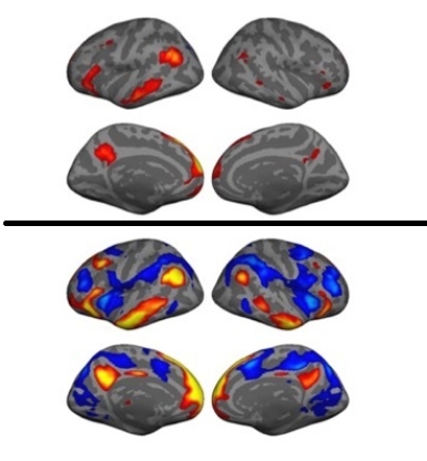 金博智慧褚明禮：經(jīng)顱直流電刺激（tDCS）改善孤獨癥兒童社交、認知的腦科學(xué)證據(jù)