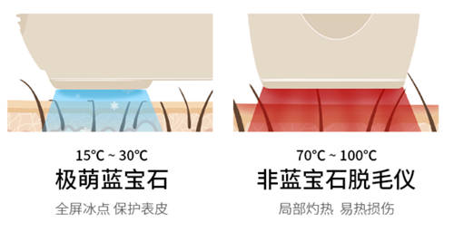 發(fā)力科技研發(fā)再次升級迭代 2022新款Ulike脫毛儀登場