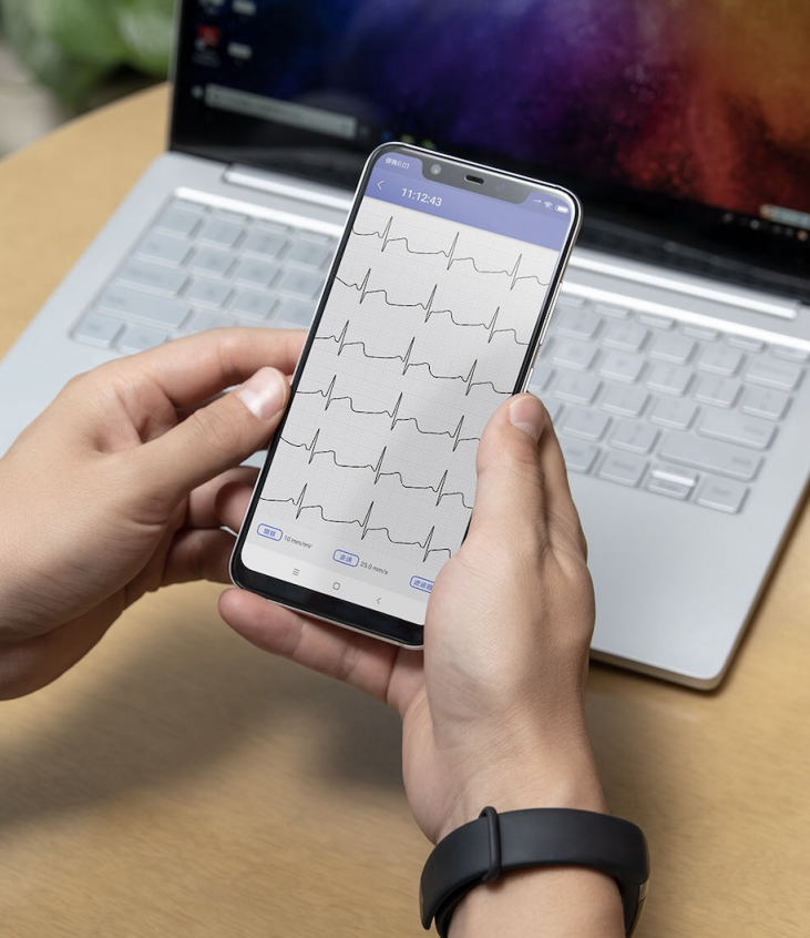 華米科技首款 Amazfit 可穿戴動態(tài)心電記錄儀問世 進軍可穿戴醫(yī)療領域