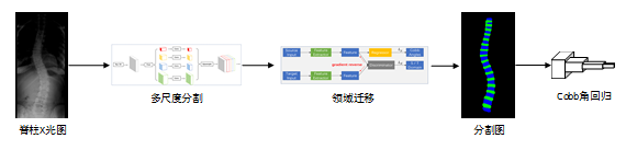 斬獲2019 MICCAI AASCE第一，騰訊優(yōu)圖醫(yī)療AI再獲突破