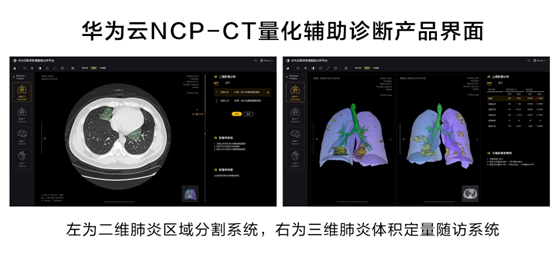 華為云推出新冠肺炎AI輔助診斷服務(wù)，疫情期間免費對定點收治醫(yī)院開放