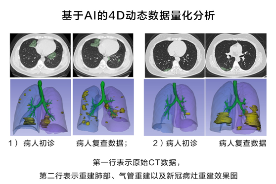 華為云推出新冠肺炎AI輔助診斷服務(wù)，疫情期間免費對定點收治醫(yī)院開放