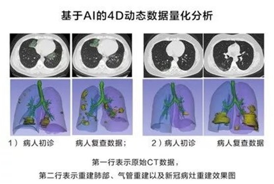 非常時期下的城市防控、生產(chǎn)與治理，華為云用AI“全鏈條“戰(zhàn)疫