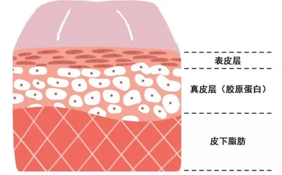 不做表面功夫，潤致娃娃針+分層抗衰讓你年齡滿40減20